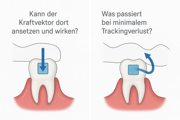 Kraftvektoren und Trackingverlust